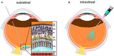 Retinal Gene Therapy: Surgical Vector Delivery in the Translation to Clinical Trials